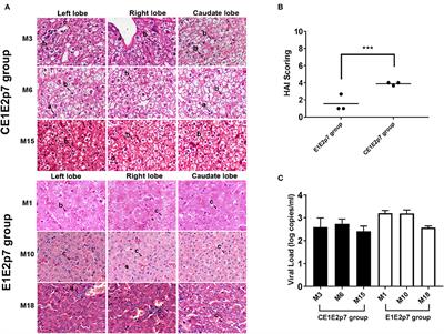 Marmoset Viral Hepatic Inflammation Induced by Hepatitis C Virus Core Protein via IL-32